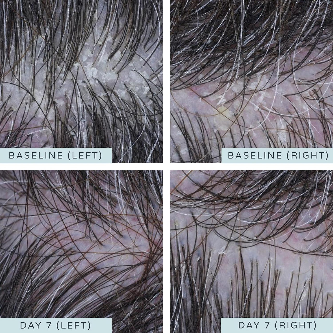 AMELIORATE Transforming Scalp Serum - 125ml