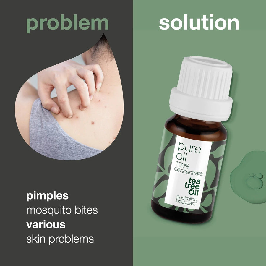 Australian Bodycare Pure Tea Tree Oil - 100% Concentrated & Natural (10ml) - liquidation.store