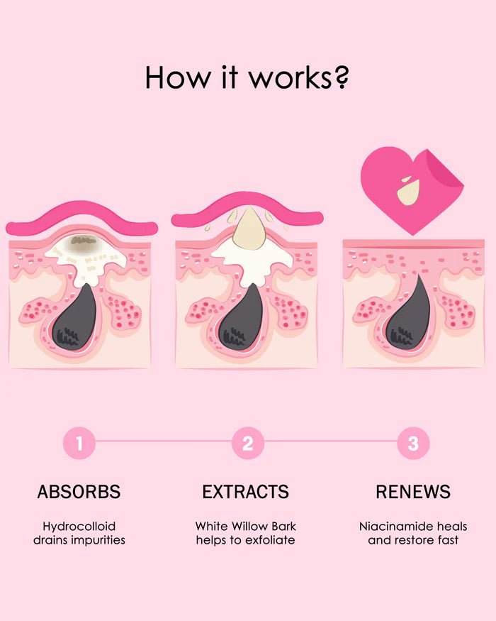 CHOK BEAUTY Niacinamide Acne Patches (3 Pack) - liquidation.store