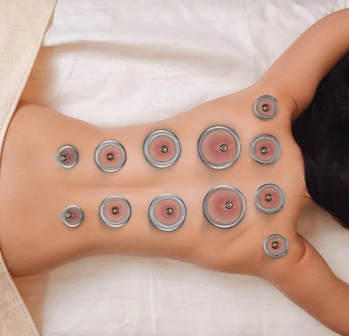 Purava Premium 12pc Cupping Therapy Set With Vacuum Pump - liquidation.store